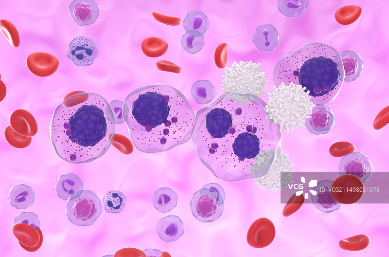 T细胞攻击多发性骨髓瘤细胞图片素材