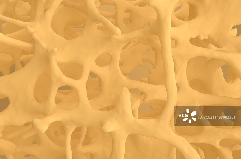 骨质疏松骨组织插图图片素材