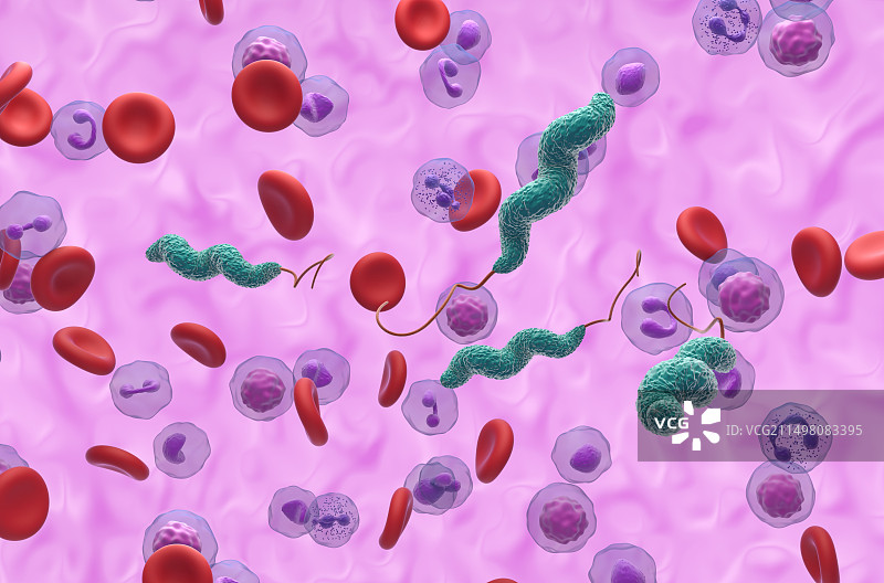 空肠弯曲菌感染示意图图片素材