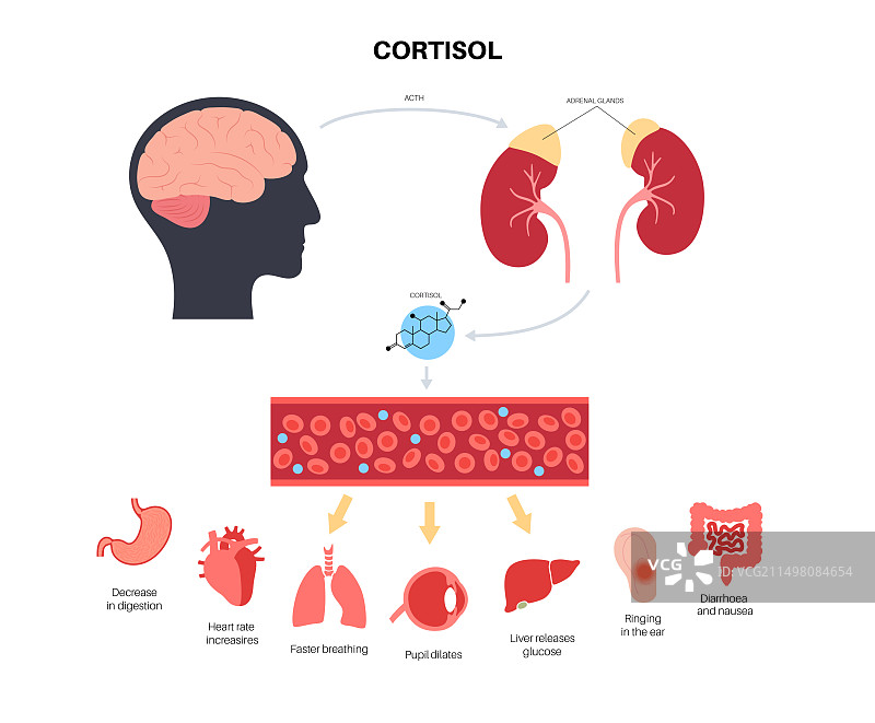 压力反应，图示图片素材