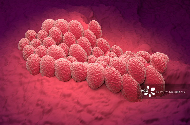 子宫内膜癌插图图片素材