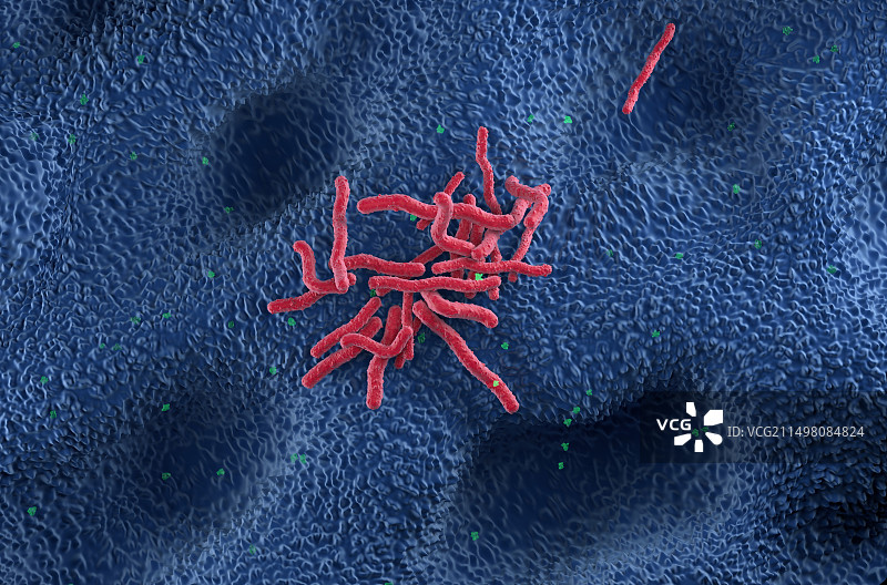 幽门螺杆菌示意图图片素材