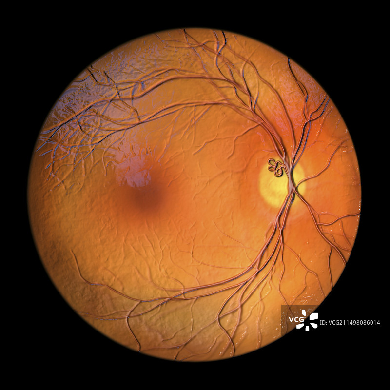 视网膜血管袢图示图片素材