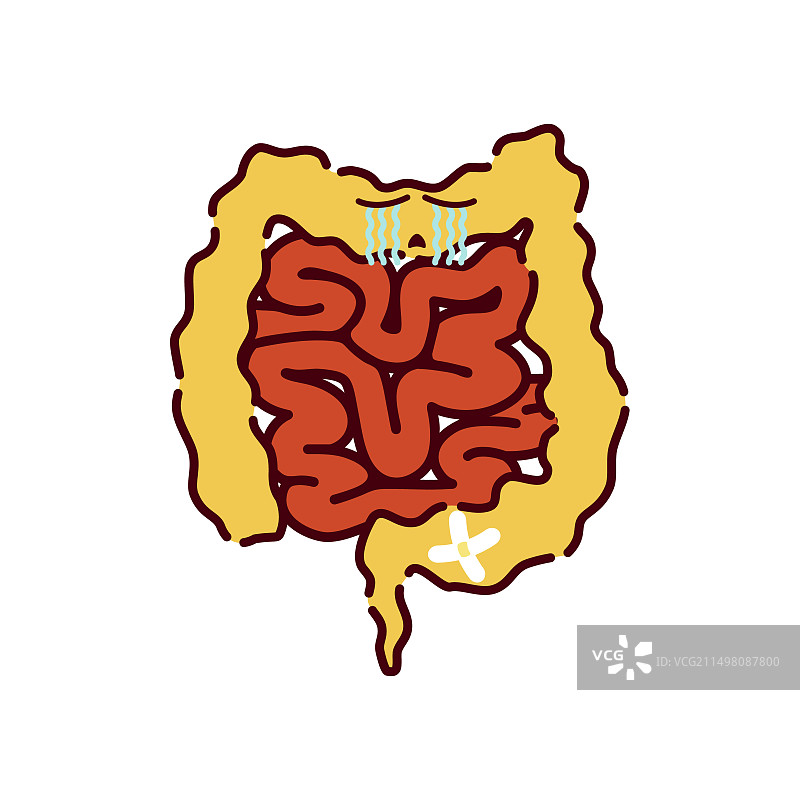 溃疡性结肠炎概念图图片素材