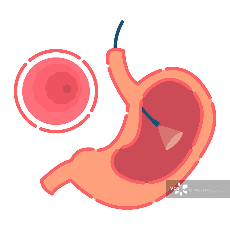 胃镜检查概念图图片素材