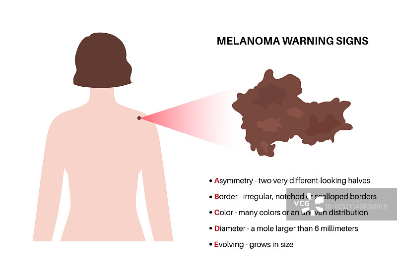 黑色素瘤警告标志插图图片素材