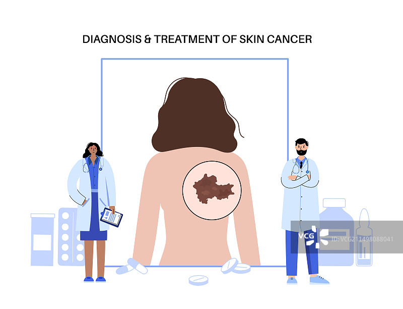 皮肤癌治疗概念图图片素材