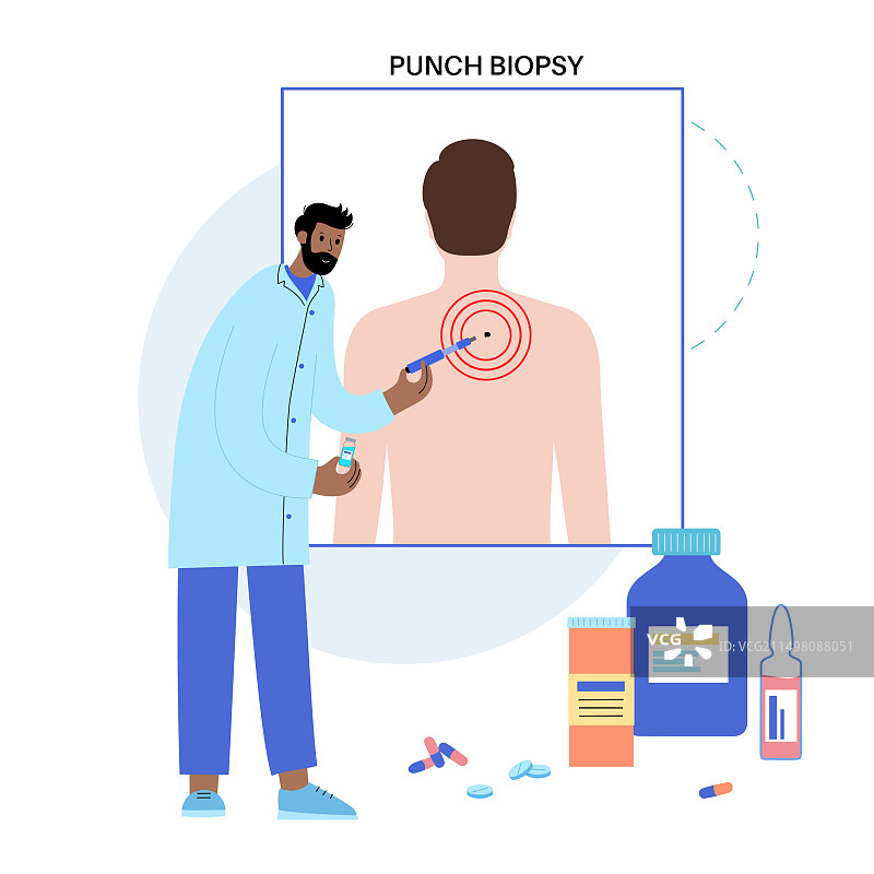 冲压活检图示图片素材
