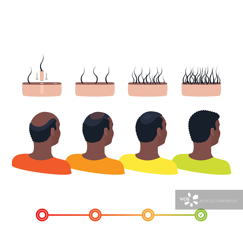 植发概念插图图片素材