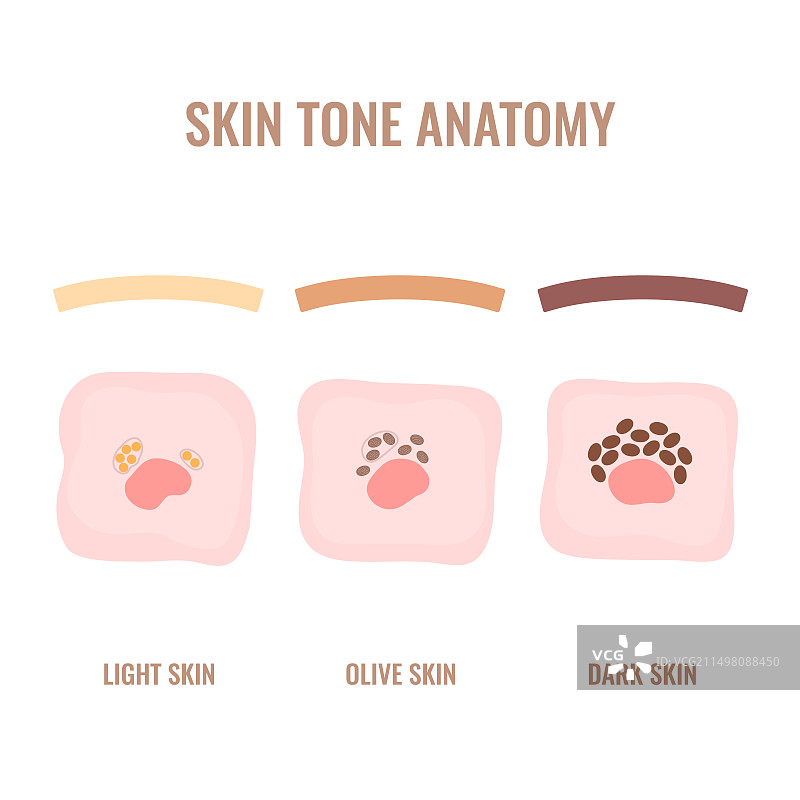 皮肤色素沉淀概念图图片素材