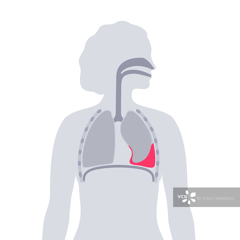 血胸插画图片素材