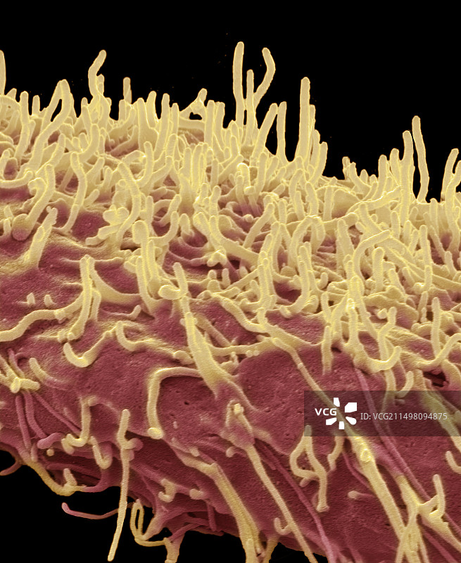 脑癌细胞扫描电镜图图片素材