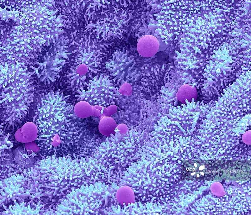 子宫内膜扫描电镜图图片素材