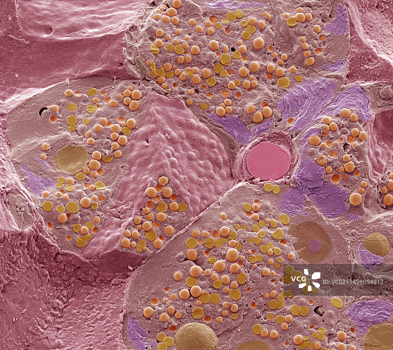 胰腺组织扫描电镜图图片素材