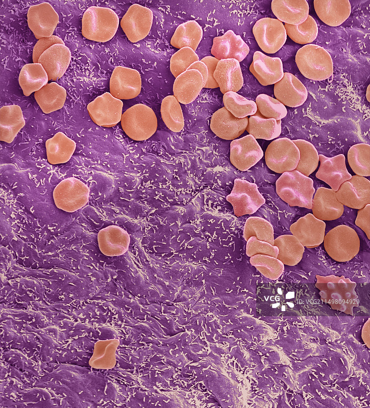 心室扫描电镜图图片素材