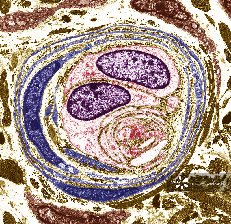 神经末梢TEM图片素材