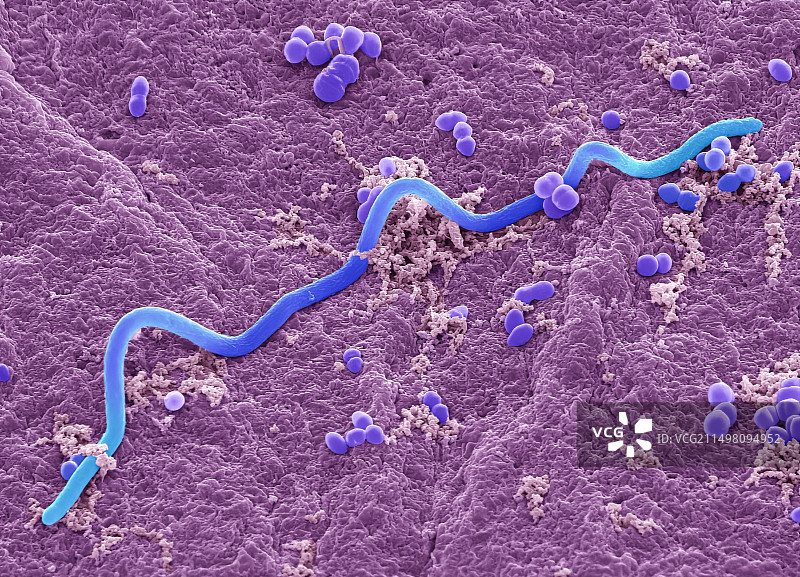 粪便细菌扫描电镜图图片素材