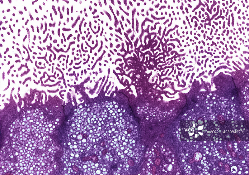 附睾，TEM图片素材