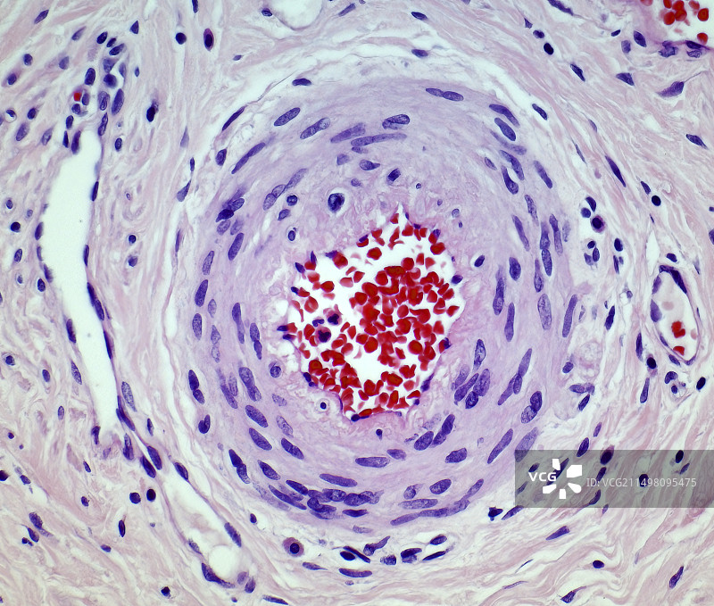 小动脉，LM图片素材