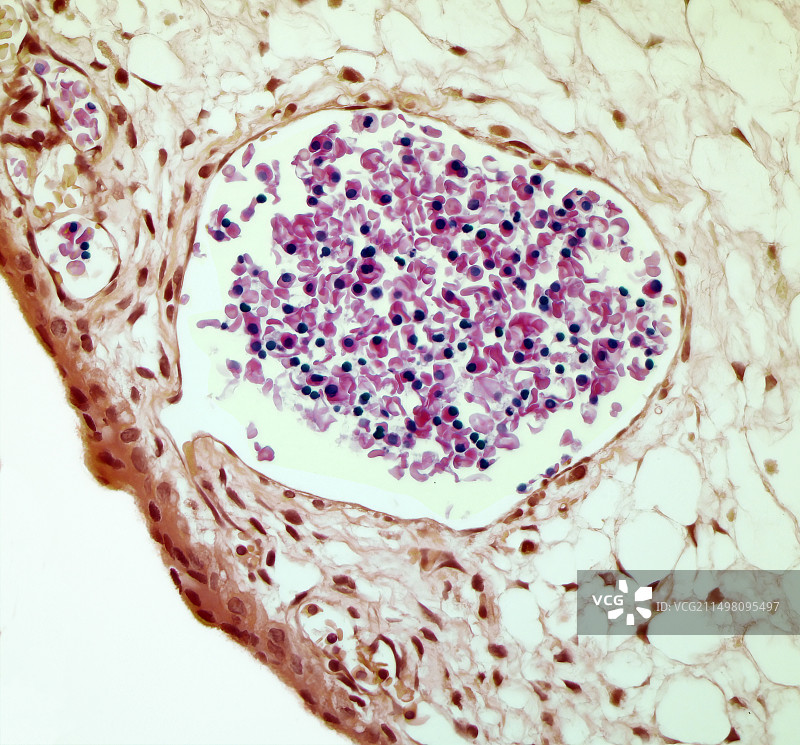 胎盘中的有核红细胞，LM图片素材