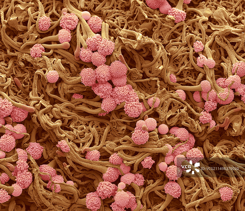 具有耐药性的曲霉菌，扫描电镜图片素材