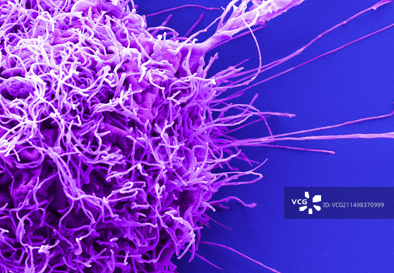 宫颈癌细胞扫描电镜图图片素材