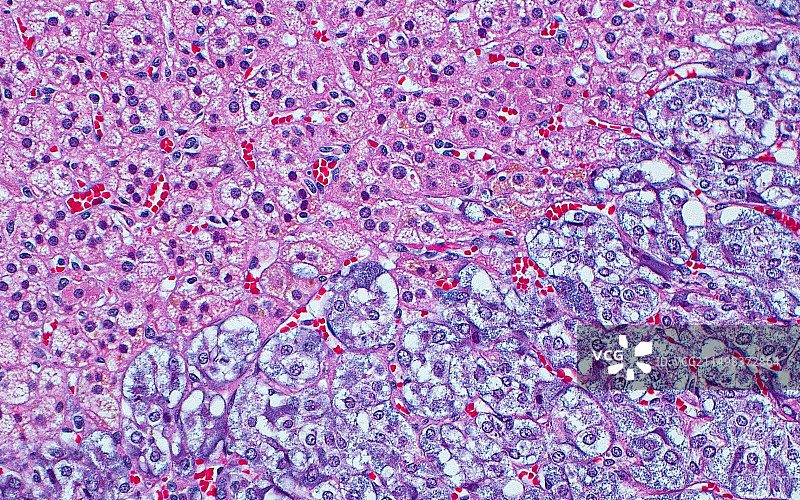 肾上腺皮质和髓质细胞显微照片图片素材