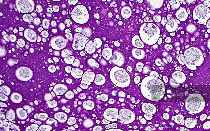 精囊分泌物显微照片图片素材