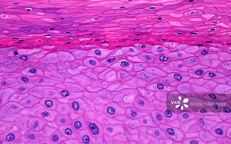 皮肤表皮鳞状细胞，光学显微照片图片素材
