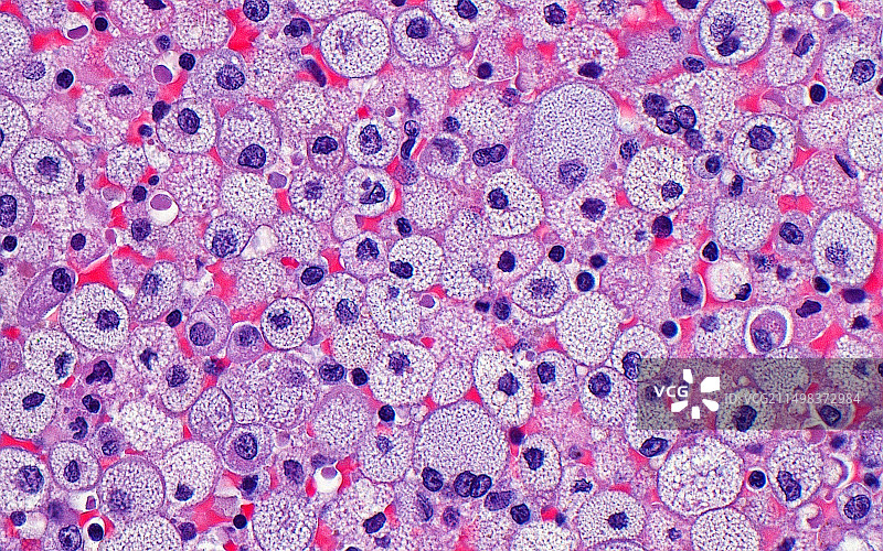 泡沫组织细胞浅显显微照片图片素材