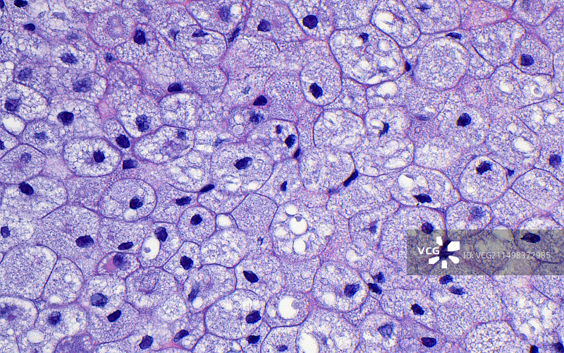 泡沫组织细胞浅显显微照片图片素材