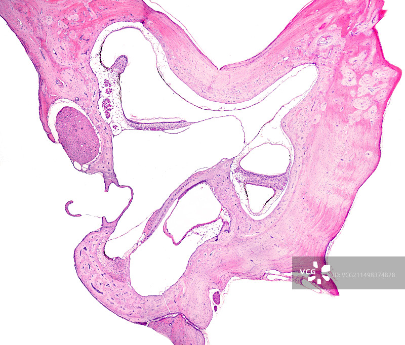 内耳光学显微照片图片素材