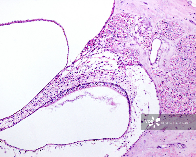 球囊耳蜗显微照片图片素材