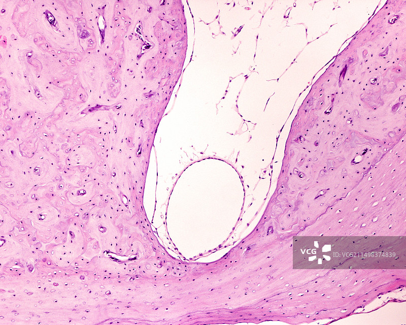 半规管显微照片图片素材