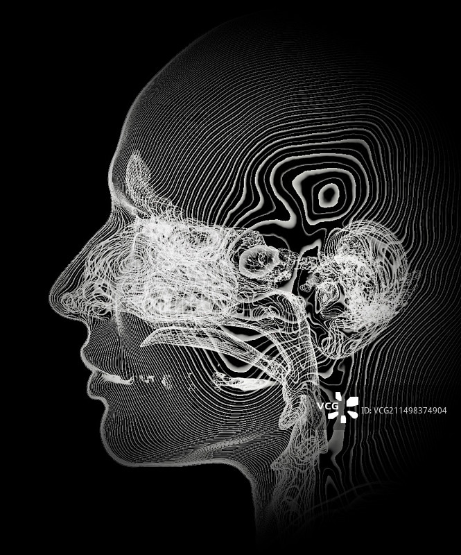 上呼吸道和耳朵CT扫描图片素材