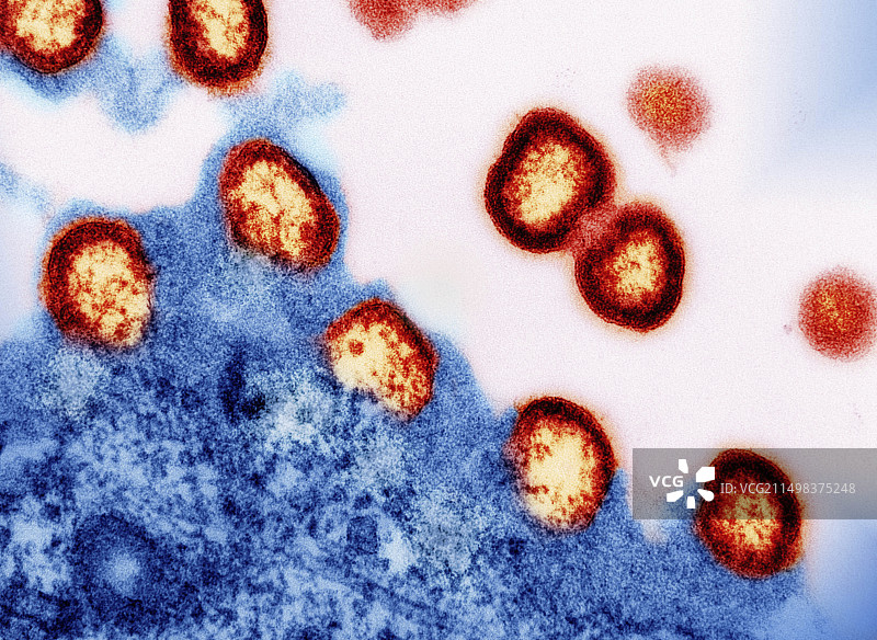 HIV-1病毒颗粒，透射电镜图片素材