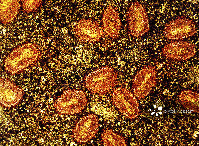 猴痘病毒颗粒TEM图片素材