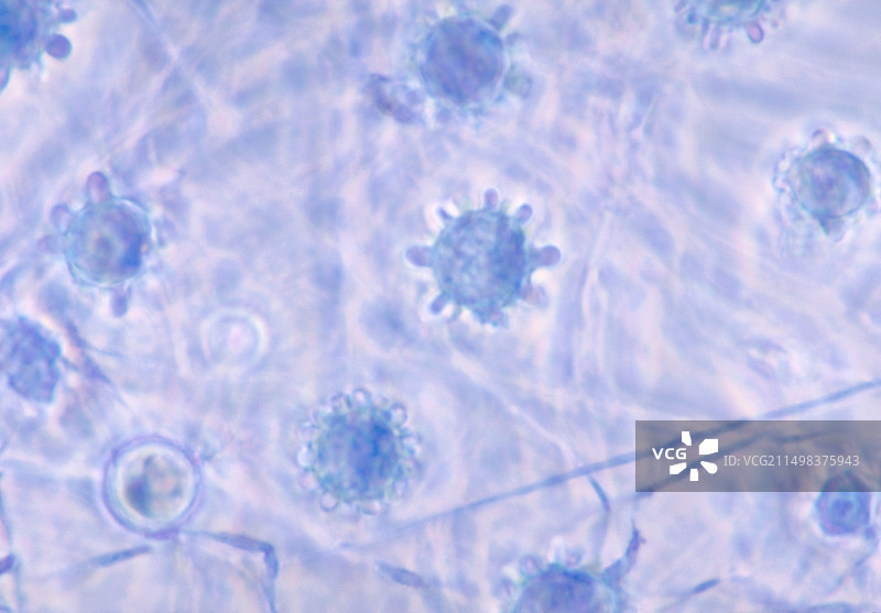 荚膜组织胞浆菌，光学显微照片图片素材