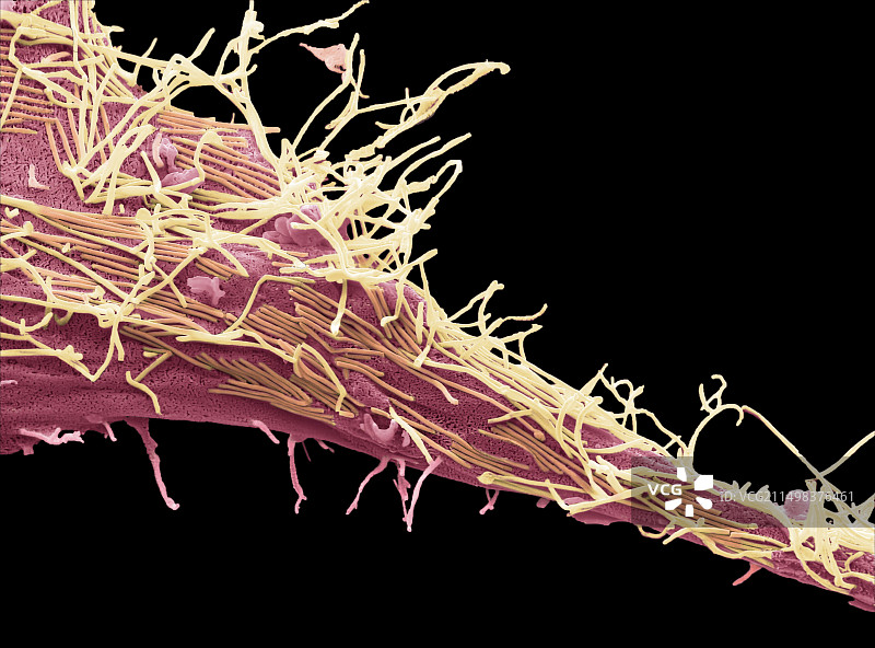 人偏肺病毒扫描电镜图图片素材