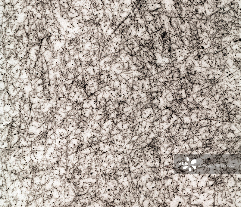 透明软骨基质超微结构（透射电镜）图片素材