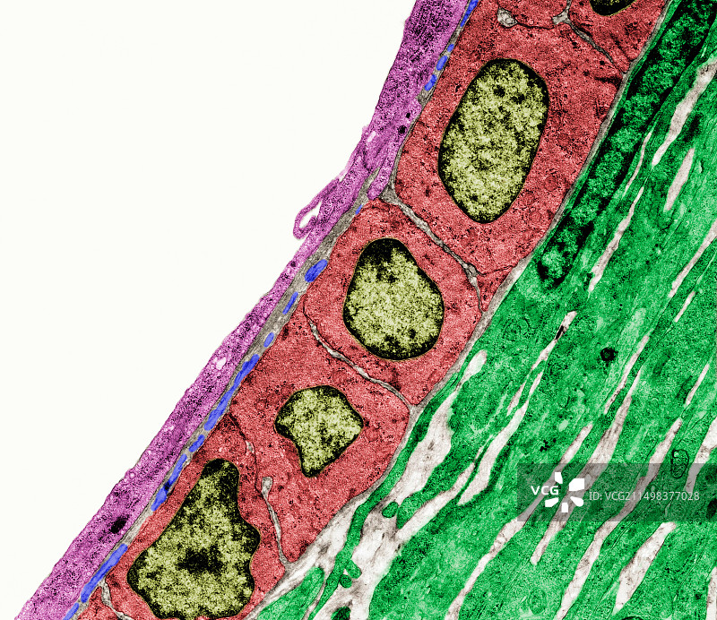 小动脉超微结构，TEM图片素材