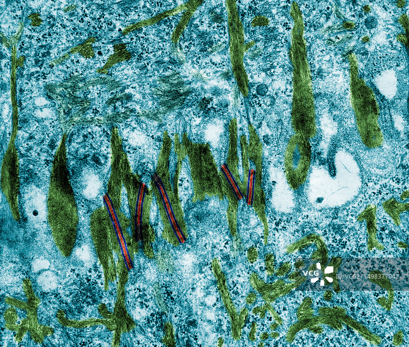表皮中的桥粒（透射电镜）图片素材