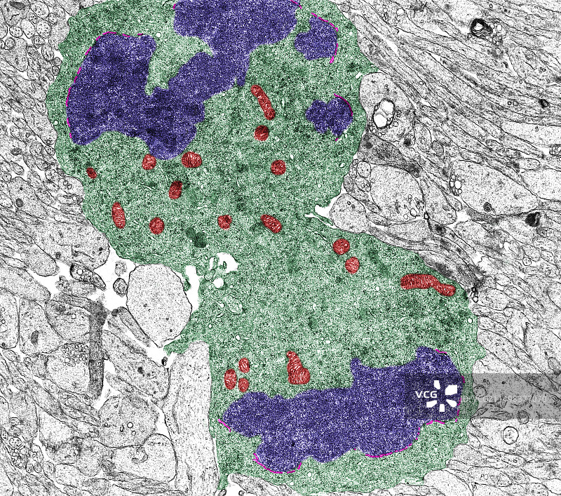 有丝分裂末期，TEM图片素材