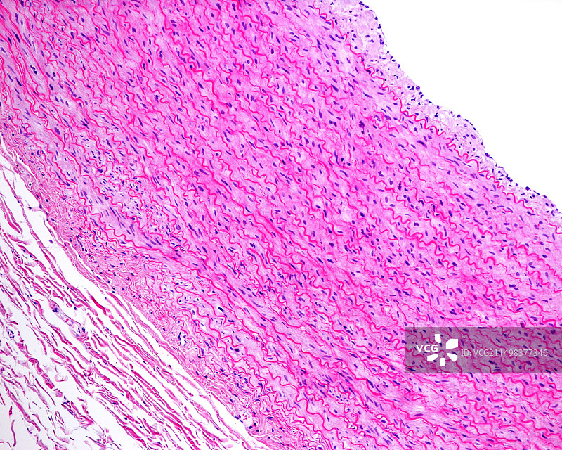 弹性动脉的中膜，光学显微照片图片素材