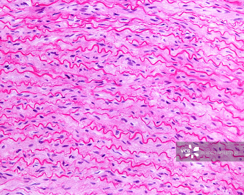 弹性动脉的中膜，光学显微照片图片素材