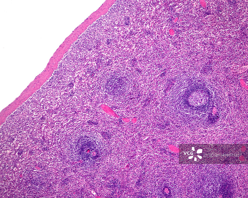 人类脾脏，光学显微照片图片素材