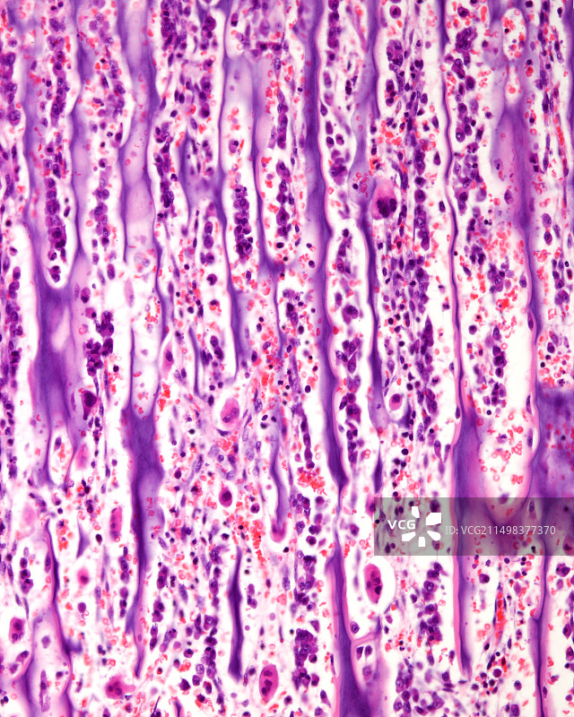 骨骺生长板的光学显微照片图片素材