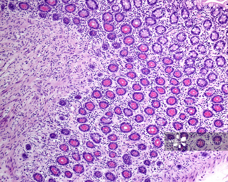 小肠潘氏细胞，光学显微照片图片素材