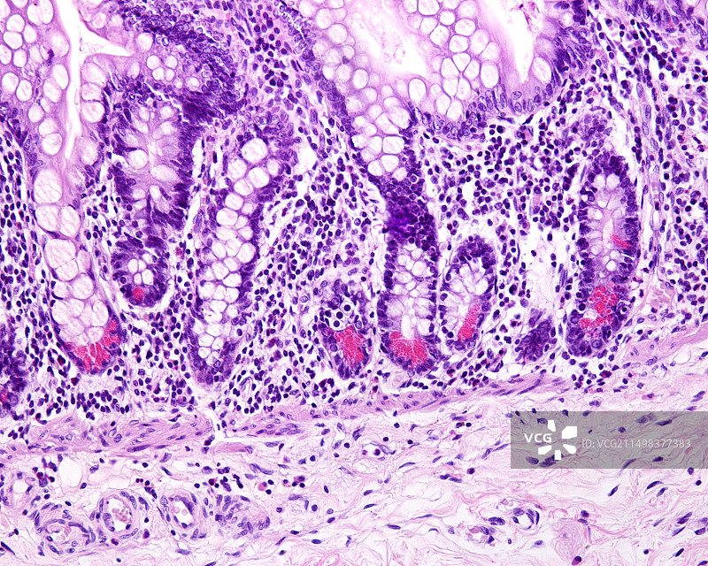 小肠潘氏细胞，光学显微照片图片素材