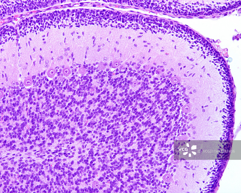 未成熟的小脑，光学显微照片图片素材